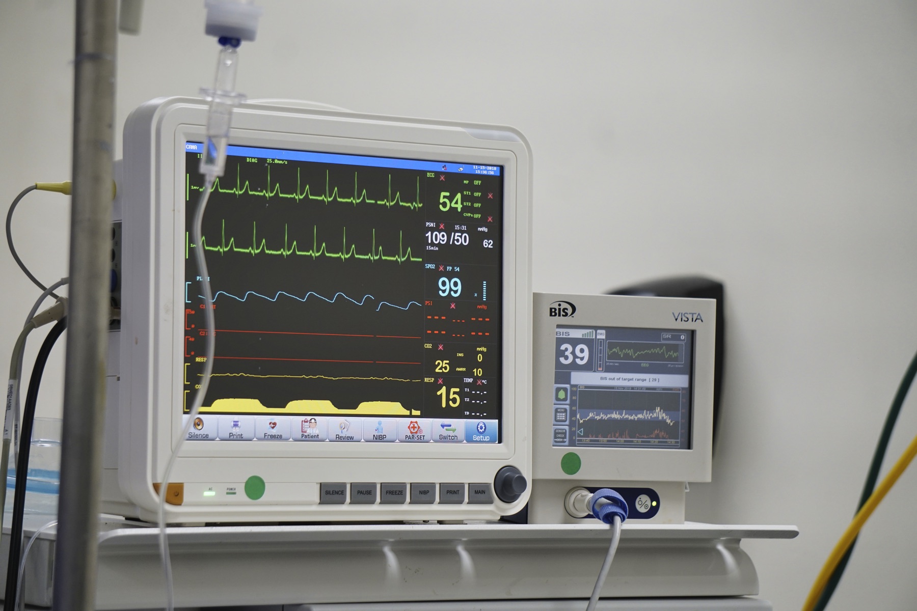 Magnesio en Torsade de Pointes: 2 g IV en 5-10 min. No esperes el QTc