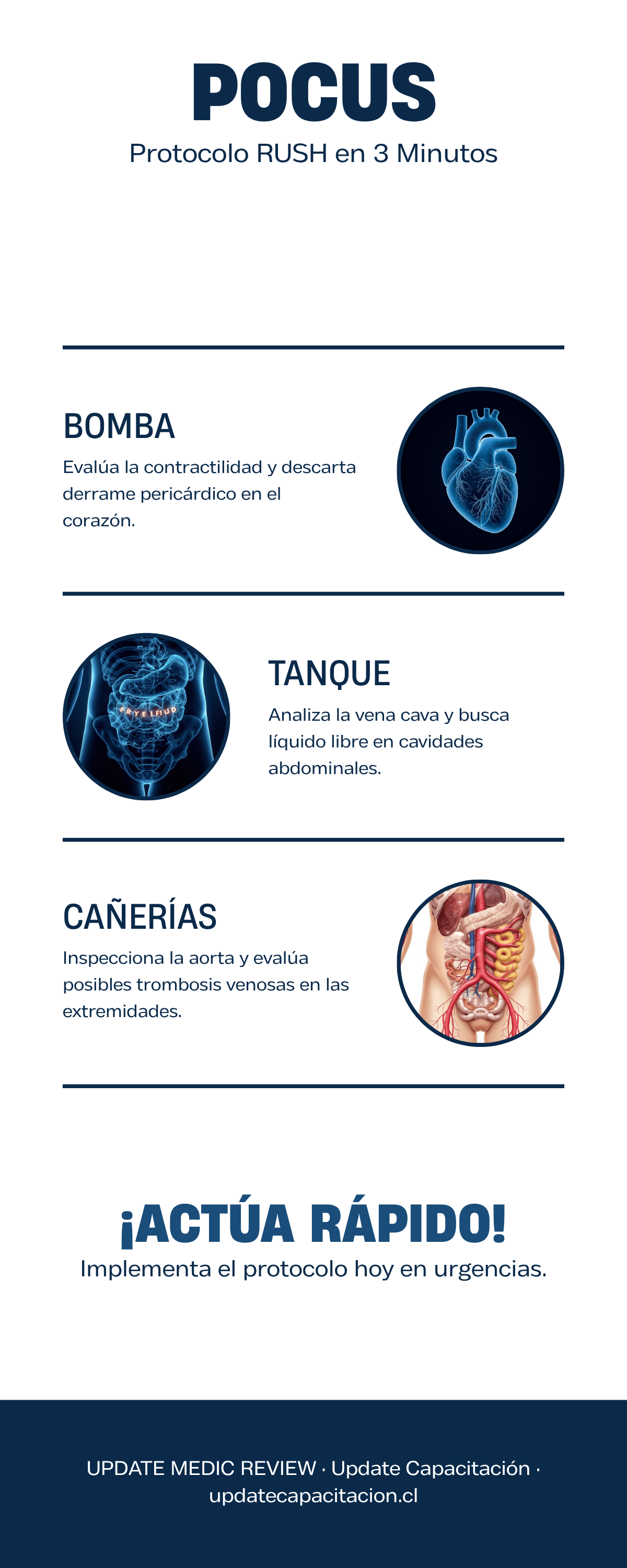 Tu FAST negativo no descarta nada — y lo sabes